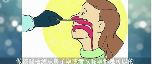 2021核酸检测要怎么做